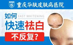 重庆华肤白癜风医院：散发性白癜风该如何去护理