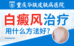 重庆华肤白癜风医院：脸部白癜风的症状表现是什么
